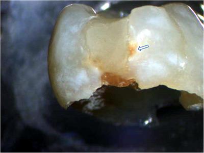 Chemometrics-Assisted Raman Spectroscopy Characterization of Tunable Polymer-Peptide Hybrids for Dental Tissue Repair